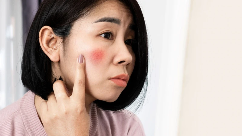 Lang ben ở mặt có khó trị không? Cách điều trị 2