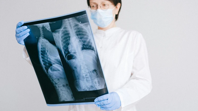 Lao thanh quản là gì? Những vấn đề cần biết lao về lao thanh quản 2
