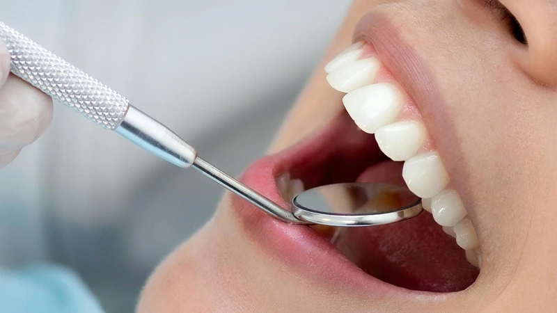 Trong quá trình lấy cao răng, nha sĩ có thể quan sát tổng thể tình trạng răng miệng