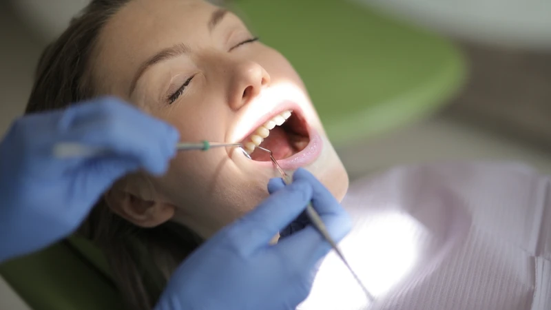 Phần lớn trường hợp không cần gây tê vì cảm giác chỉ ở mức ê buốt nhẹ