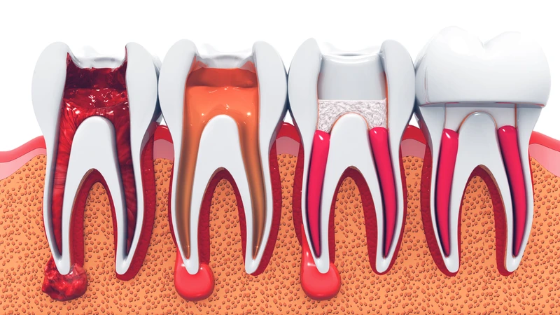 Sau khi quy trình hoàn tất, răng của bạn sẽ hoạt động bình thường