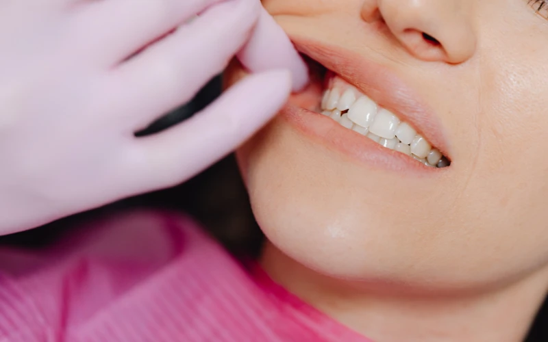 Trường hợp đau tái phát sau khi đã điều trị tủy lần 1, bác sĩ có thể chỉ định lấy tủy lại lần 2