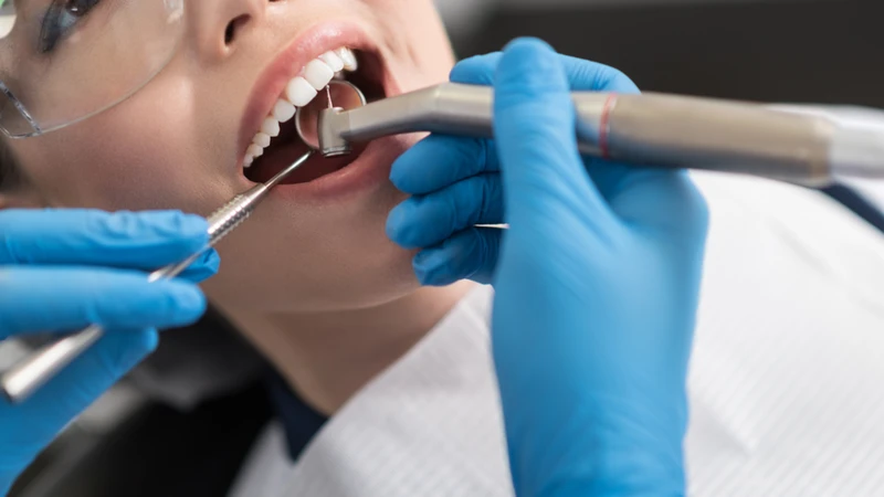 Lấy tủy răng mất bao lâu? Lấy tủy răng diễn ra gọn nhẹ, khoảng 30 đến 90 phút tùy độ phức tạp của răng