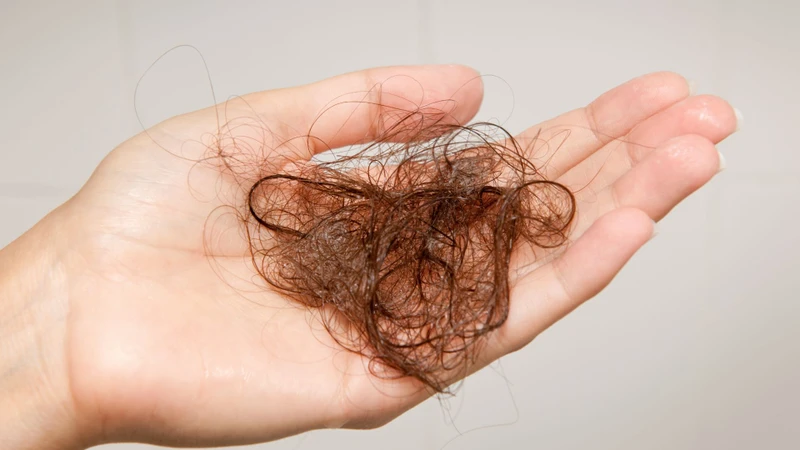 Liệu bệnh phong cùi có lây không​? Biểu hiện của bệnh phong cùi là gì? 3