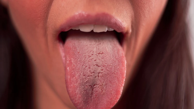 Một số nguyên nhân khác có thể gây nứt lưỡi