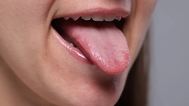 Lưỡi người bình thường thường có màu hồng nhạt, bề mặt mềm mại và được phủ một lớp gai lưỡi mỏng, đều