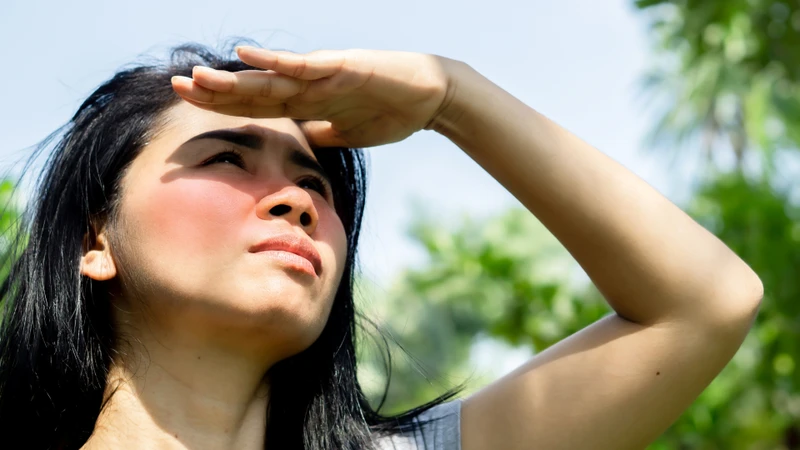 Bảo vệ da khỏi ánh nắng giúp hạn chế các yếu tố liên quan đến triệu chứng