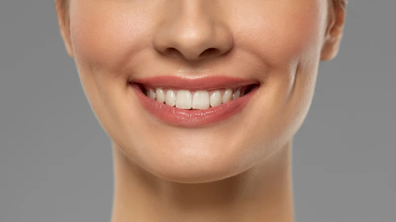 Má lúm đồng tiền là những vết lõm nhỏ đáng yêu xuất hiện trên má khi cười