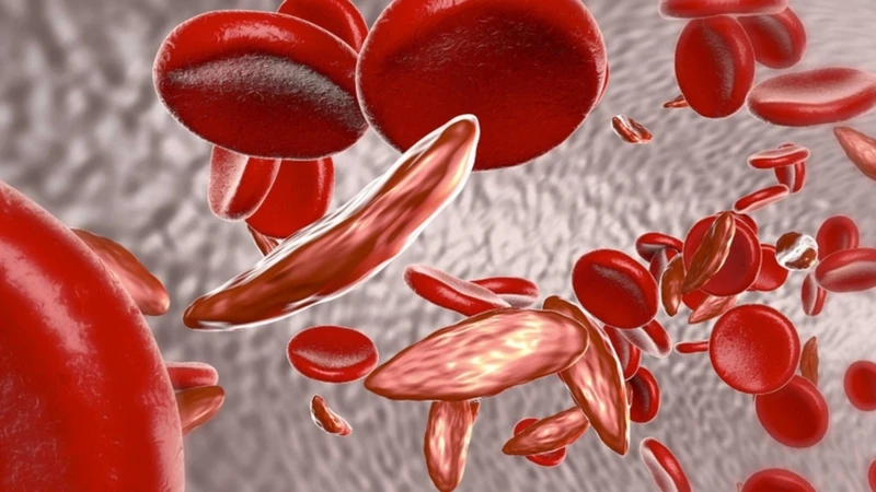 Thalassemia xảy ra khi cơ thể bị đột biến gen liên quan đến quá trình tạo hemoglobin