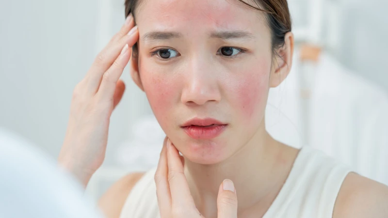 Viêm mao mạch dị ứng là một bệnh lý khá phổ biến