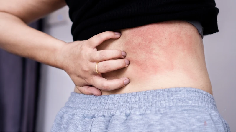 Men gan cao gây ngứa​ do đâu?4