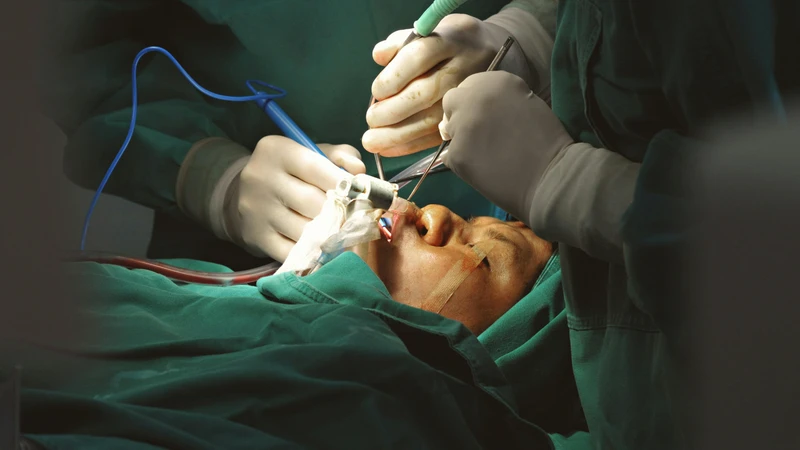 Phẫu thuật hạt xơ thanh quản được chỉ định khi triệu chứng bệnh trở nên nghiêm trọng