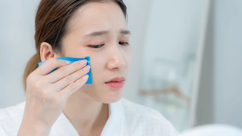 Khí hậu nóng ẩm khiến cơ thể tăng tiết mồ hôi và dầu, làm tình trạng kéo dài quanh năm