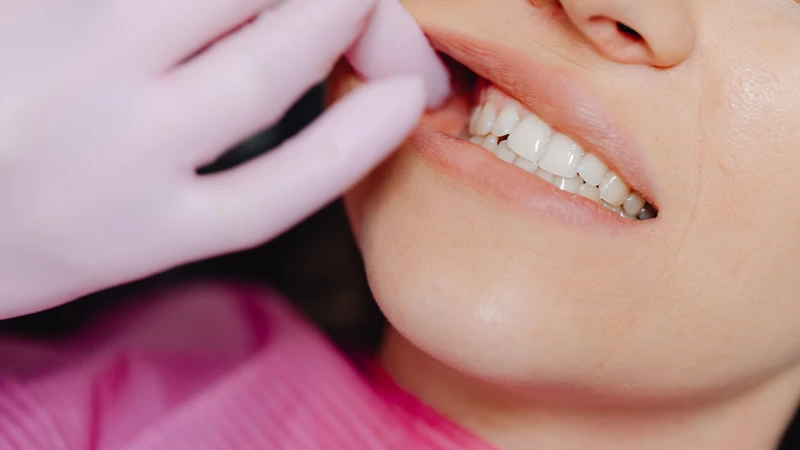 Mọc răng khôn có sốt không cần nhìn dưới góc độ y khoa
