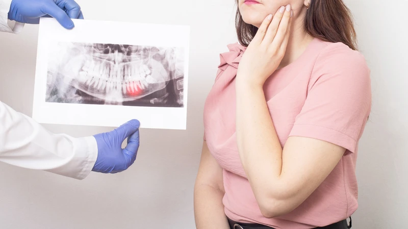 Mọc răng khôn có sốt không và khi nào cần đi khám?