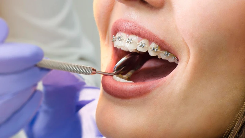 Nếu cơn đau kéo dài nên đến nha khoa để được kiểm tra và xử trí kịp thời