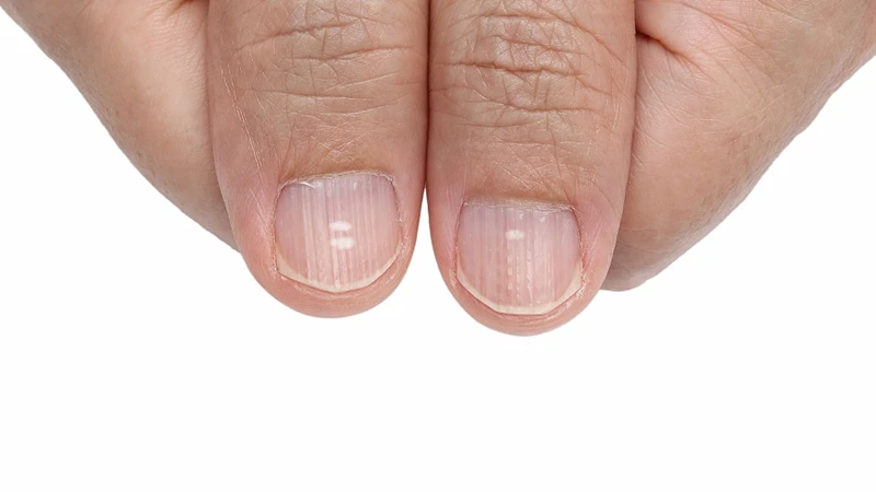 Một số vi chất góp phần duy trì móng khỏe mạnh