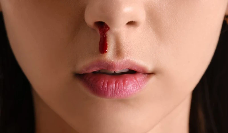 Mũi là gì? Cấu tạo mũi và chức năng quan trọng đối với con người 5