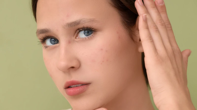 Có nhiều nguyên nhân gây mụn ẩn dưới da