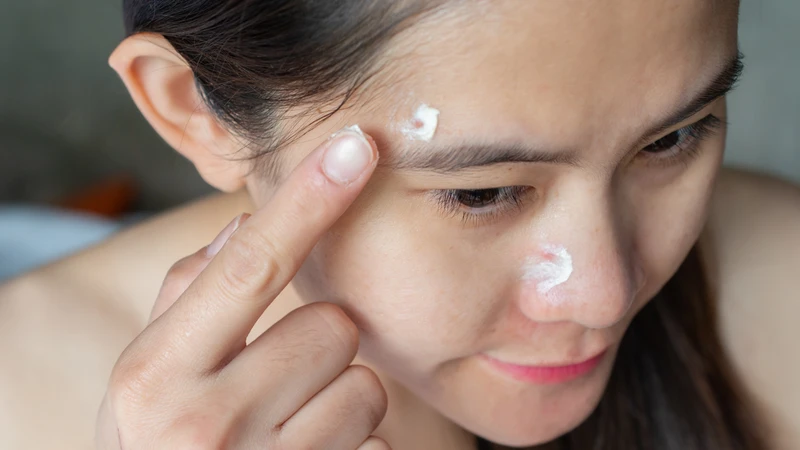 Mụn bọc sưng to​ phải làm sao? Cần lưu ý điều gì khi điều trị? 2