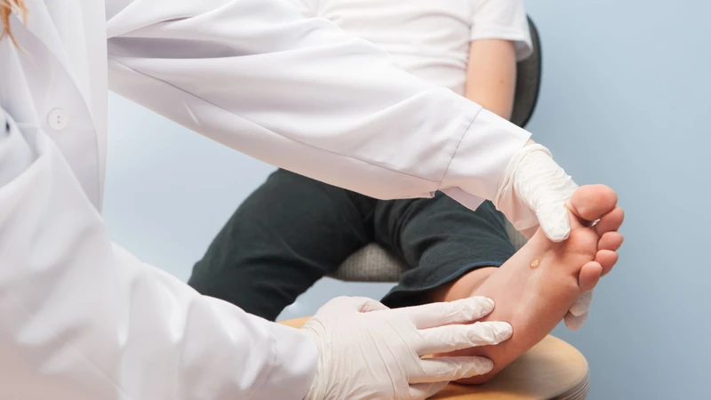 Mụn cóc ở trẻ em có khả năng lây lan không? Cách điều trị hiệu quả? 1