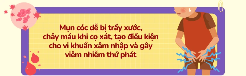 Mụn cóc sinh dục: Càng chần chừ điều trị càng khó kiểm soát 5