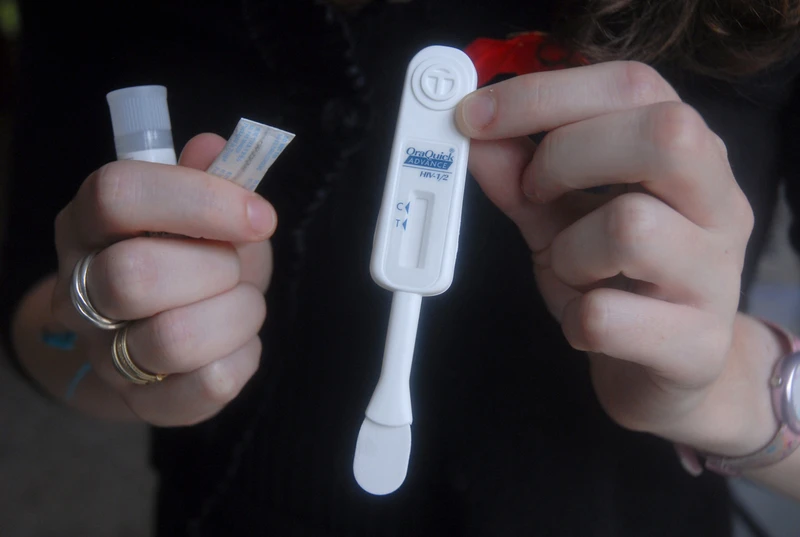 Mụn HIV là gì? Phân biệt mụn HIV và mụn thông thường 3