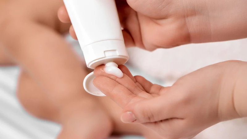 Cha mẹ cần tránh nặn hay bôi thuốc tùy tiện khi trẻ bị mụn kê