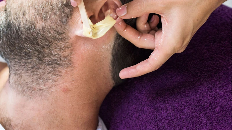 Mụn nhọt ở tai: Cách xử lý an toàn và phòng ngừa tái phát 3