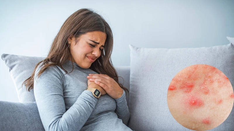 Mụn ở ngực: Nguyên nhân, cách điều trị và phòng ngừa hiệu quả 2
