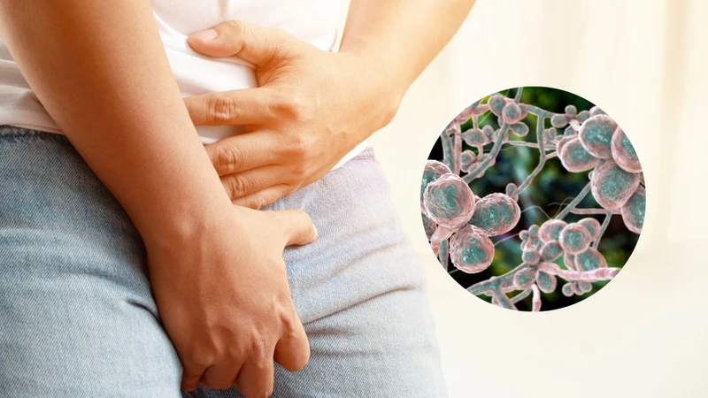 Nấm dương vật: Nguyên nhân, triệu chứng, chẩn đoán, điều trị và phòng ngừa 1
