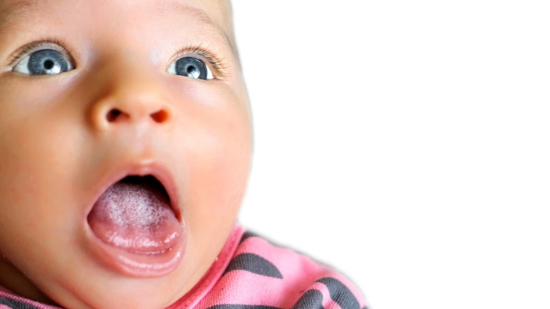 Nấm Lưỡi ở Trẻ Sơ Sinh: Nguyên Nhân, Triệu Chứng và Phương Pháp Điều Trị 4