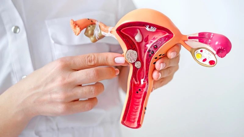 Nang Naboth cổ tử cung là một túi dịch nhỏ, trong suốt hoặc hơi đục, nằm ngay trên bề mặt cổ tử cung
