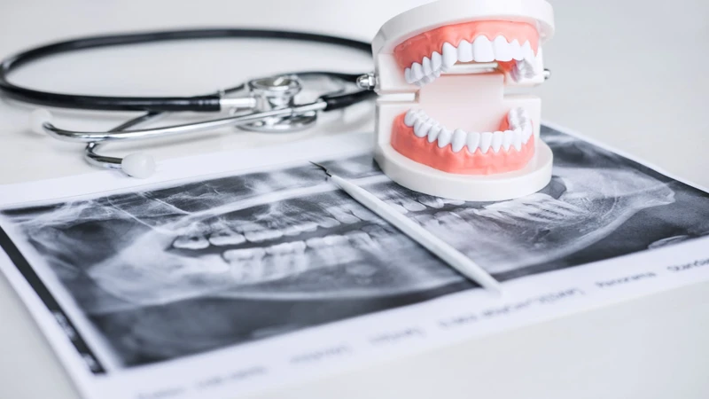 Nghiến răng ở trẻ có thể dẫn đến mòn răng và ảnh hưởng khớp hàm nếu kéo dài