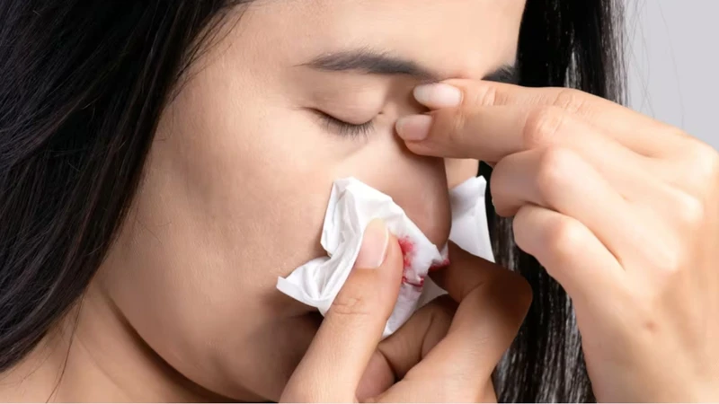 Xì mũi mạnh hoặc ngoáy mũi có thể làm tổn thương niêm mạc