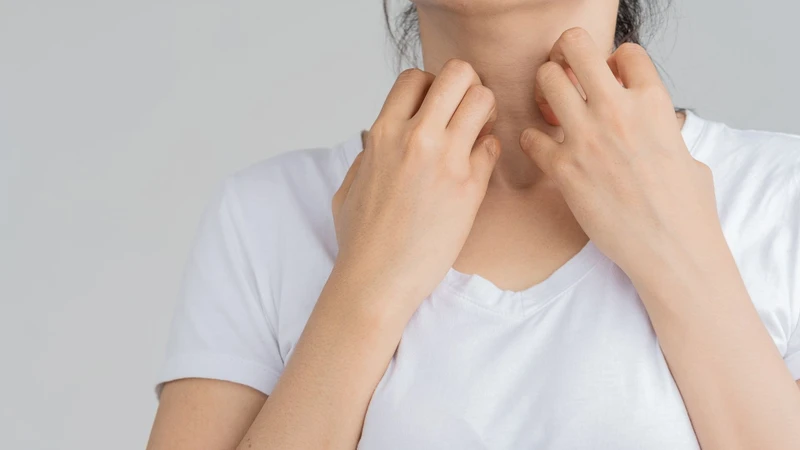 Ngứa do ứ mật liên quan đến rối loạn dòng chảy của mật