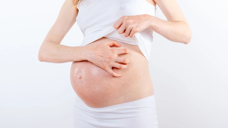Các nguyên nhân gây ngứa do ứ mật