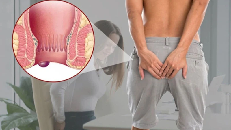 Ngứa hậu môn: Nguyên nhân, dấu hiệu cảnh báo bệnh lý và cách xử lý hiệu quả 3