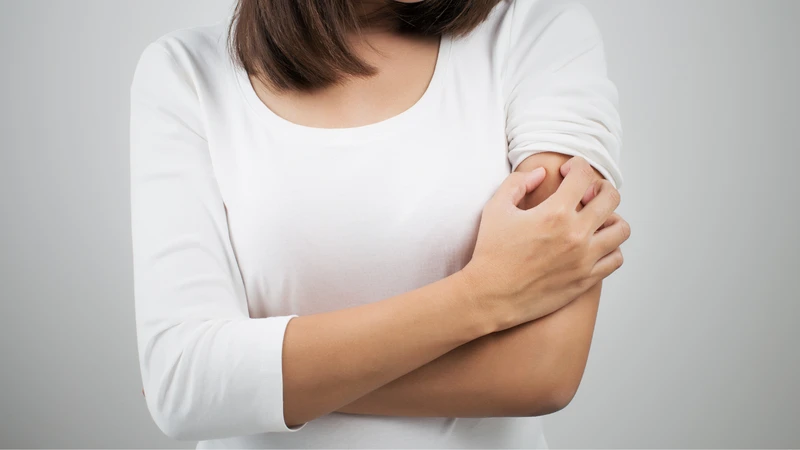 Ngứa sau khi tiêm vắc xin có đáng lo? Hướng dẫn cách xử lý cơn ngứa an toàn 1