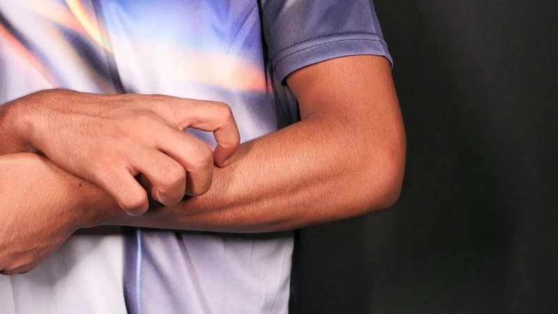 Ngứa toàn thân là bệnh gì? Cảm giác ngứa toàn thân do nguyên nhân nào gây ra? 1