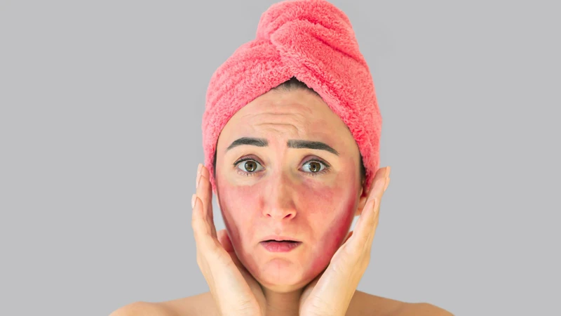 Người bị lupus ban đỏ có nên lấy chồng​ không? Bị lupus ban đỏ cần lưu ý gì khi mang thai? 2