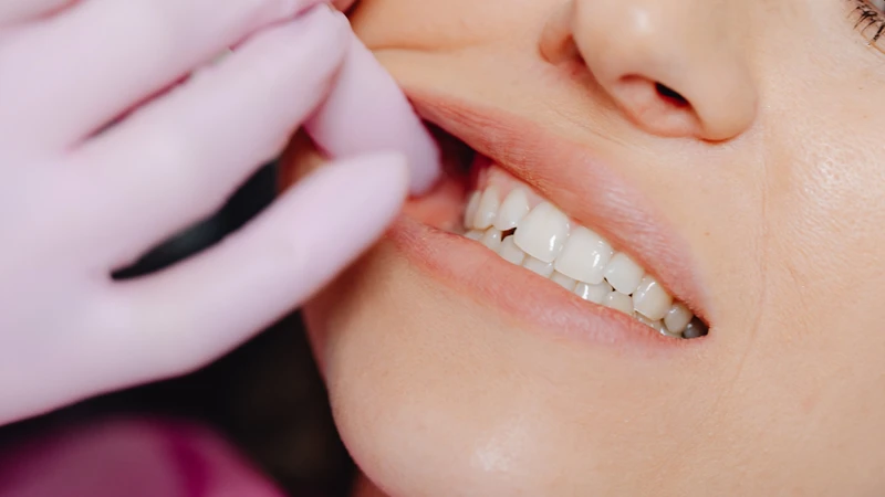 Chỉ còn 24 cái răng thì có sao không là một trong số những thắc mắc thường gặp hiện nay