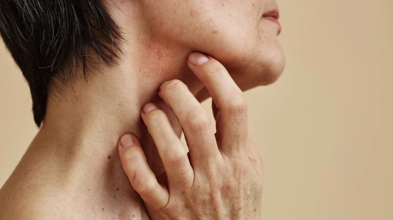 Nguyên nhân bị giời leo ở cổ và cách xử lý hiệu quả 2