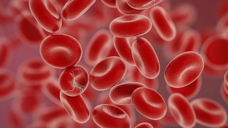 Thiếu máu thai kỳ thường do thiếu sắt tạo hemoglobin, khiến mẹ bầu dễ lạnh người, chóng mặt, hoa mắt và mệt mỏi