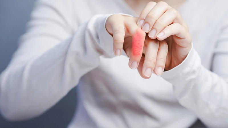 Bong gân, rách dây chằng, gãy xương hoặc trật khớp đều có thể làm ngón tay bị sưng