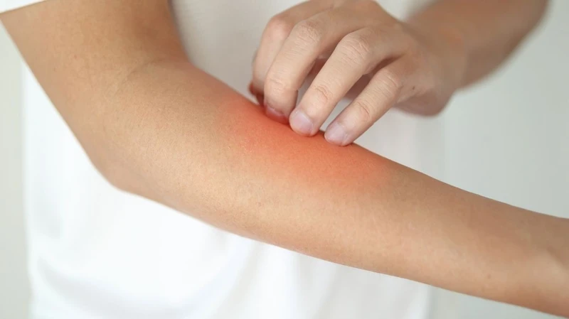 Ngứa kéo dài hoặc tái diễn nhiều lần nên đi khám bác sĩ