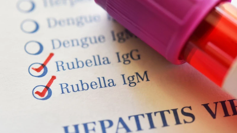 nguyen-nhan-va-cach-phong-ngua-virus-rubella-4