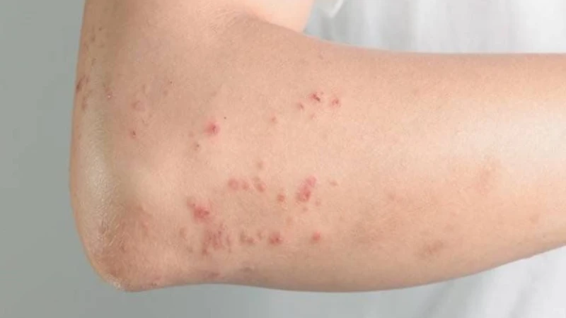 Nhận biết dấu hiệu bị nhiễm giun sán chó mèo 4