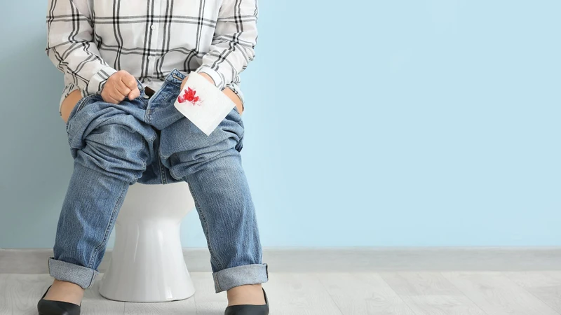 Nhận biết dấu hiệu ung thư trực tràng​ sớm, đừng bỏ qua! 2