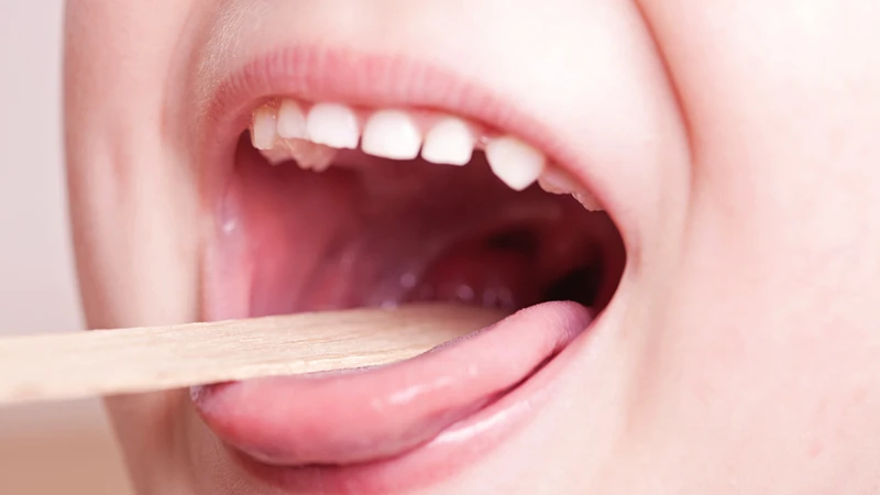 Nhận biết hình ảnh viêm họng bình thường 3